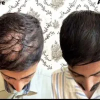 اگه مو نداری پیام بده