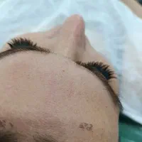 فیشال و پاکسازی|خدمات آرایشگری و زیبایی|خرمآباد, |دیوار