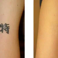 اموزش و اجرای تتو ،پاک کردن تتو با لیزر|خدمات آرایشگری و زیبایی|کرمانشاه, |دیوار