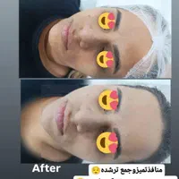 مرکز لیزر غزل|خدمات آرایشگری و زیبایی|ایذه, |دیوار