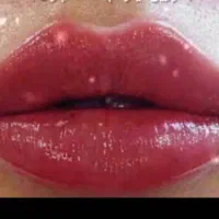 کلینیک تزریق ژل لب روسی فیلر چانه لیزر لیفت صورت|خدمات آرایشگری و زیبایی|تهران, صادقیه|دیوار