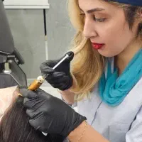 درمان ریزش مو