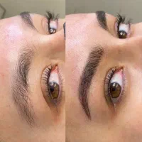 میکروبلدینگ و فیبروز ابرو