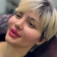 تزریق ژل،بوتاکس،فیلر،مزوتراپی،پی آر پی لیزر  هایفو|خدمات آرایشگری و زیبایی|اردبیل, |دیوار