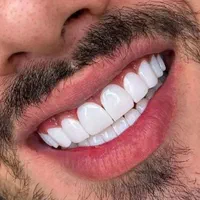 دندانپزشکی با خدمات کامل و شرایط اقساط ویژه|خدمات آرایشگری و زیبایی|اصفهان, لاله|دیوار