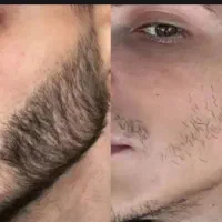 تضمینی بدون بازگشت
