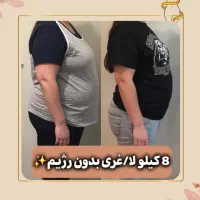 جشنواره لاغری در کلینیک پزشکی(امکان پرداخت قسطی)