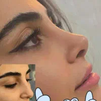 مرکزفوق تخصصی جراحی بینی/وجشنواره۱۰روزهشگفت انگیز|خدمات آرایشگری و زیبایی|مشهد, احمدآباد|دیوار