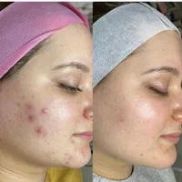 آموزش صفر تا صد پاکسازی پوست در کلینیک با مدرک فنی|خدمات آموزشی|اراک, |دیوار