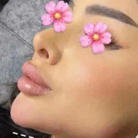 مرکز زیبایی ژل بوتاکس ۹۰ درصدی فقط فردا