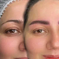 نیازمند مدل میکرو وفیبروز ابرو هستم