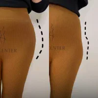 تزریق فیلر بادی برای بانوان در کلینیک آوا