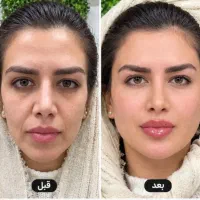 امروز1مهر/روز آخر)فقط در1جلسه1/950با10خدمات رایگان
