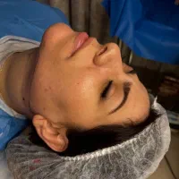 ساکشن غبغب|خدمات آرایشگری و زیبایی|پرند, فاز ۲|دیوار