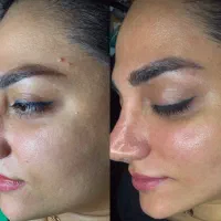 فیشال تخصصی