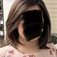 پروتز مو طبیعی وارداتی