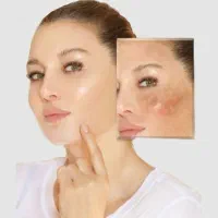 ضد افتاب|آرایشی، بهداشتی، درمانی|کرج, اخترآباد|دیوار