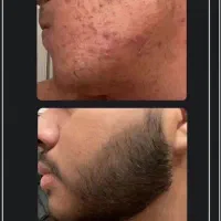 ریش نماد مردانگی