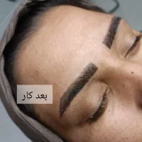 فیبروز.میکروبلیدینگ.شیدینگ لب.با قیمت اقتصادی