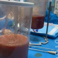 ساکشن شکم پهلو ۱۰ میلیون تومان ، پزشک ۲۰ سال تجربه|خدمات آرایشگری و زیبایی|مشهد, هفت تیر (نه دره)|دیوار