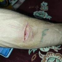 متخصص اعصاب وروان وانواع بیماریها وجواب گیری بالا