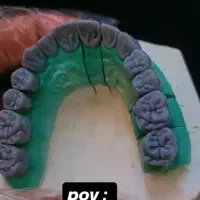 لابراتوار  دندانسازی  وکساپ  فریم