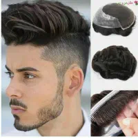 پروتز مو|آرایشی، بهداشتی، درمانی|اهواز, اهواز|دیوار