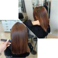 مدل برای پروتیین و بوتاکس از۷۰۰تا ۱۵۰۰