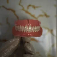 ساخت دندان مصنوعی