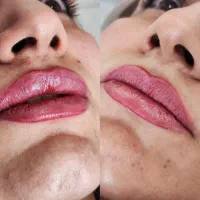 پزشک زیبایی آماده همکاری با مراکز زیبایی شاهین شهر