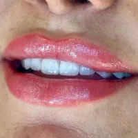 دندانپزشکی ودندانسازی|خدمات آرایشگری و زیبایی|تهران, فلسطین (میدان انقلاب)|دیوار