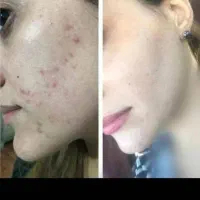 نمایندگی کرم رویال پنج تادهدرجه روشن کنندضدلک قوی|آرایشی، بهداشتی، درمانی|یاسوج, |دیوار