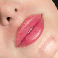 جشنواره تزریق فیلر مدت محدود فقط ۷۸۰ تومن|خدمات آرایشگری و زیبایی|زنجان, |دیوار