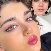 جشنواره ژل بوتاکس فیلر لیزرجوانسازمزو|خدمات آرایشگری و زیبایی|تبریز, |دیوار