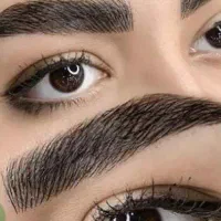 فیبروز میکرو بلیدینگ