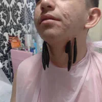 حجامت و زالو درمانی و طب سوزنی و بادکش|خدمات آرایشگری و زیبایی|ارومیه, |دیوار