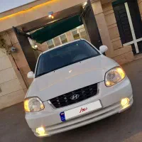 هیوندا ورنا ۸۶ فوق‌العاده تمیز و درجه یک (معاوضه)