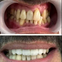 دندانپزشکی و دندانسازی تبریز