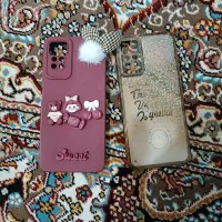 گارد گوشی نت۱۱شیائومی