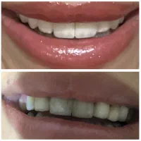 خدمات دندانپزشکی|خدمات آرایشگری و زیبایی|یاسوج, |دیوار