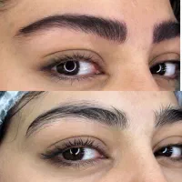 مدل میکروبلیدینک سوپرنچرال