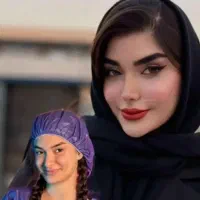 جشنواره عیدانه جراحی و عمل بینی