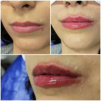 جشنواره کلینیک زیبایی دکتر فهیمه اربابی|خدمات آرایشگری و زیبایی|زابل, |دیوار