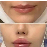 به مدل نیازمندیم باهزینه مواد