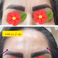 تخفیف بوتاکس، ژل، مزوژل، پی آر پی توسط پزشک|خدمات آرایشگری و زیبایی|مشهد, گوهرشاد|دیوار