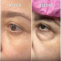 بلفارو پلاستی|خدمات آرایشگری و زیبایی|ری, علایین|دیوار