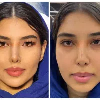 مرکز تخصصی فرم دهی و‌لیفت بینی و صورت با نخ و‌ژل|خدمات آرایشگری و زیبایی|مشهد, احمدآباد|دیوار