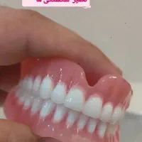دندان مصنوعی  ( تمام چک )