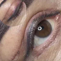 تخفیف ویژه جراحی پلک(بلفاروپلاستی)ژل لب یک میلیون|خدمات آرایشگری و زیبایی|مشهد, فردوسی|دیوار