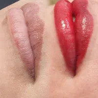 میکروبلیدینگ شیدینگ خط چشم